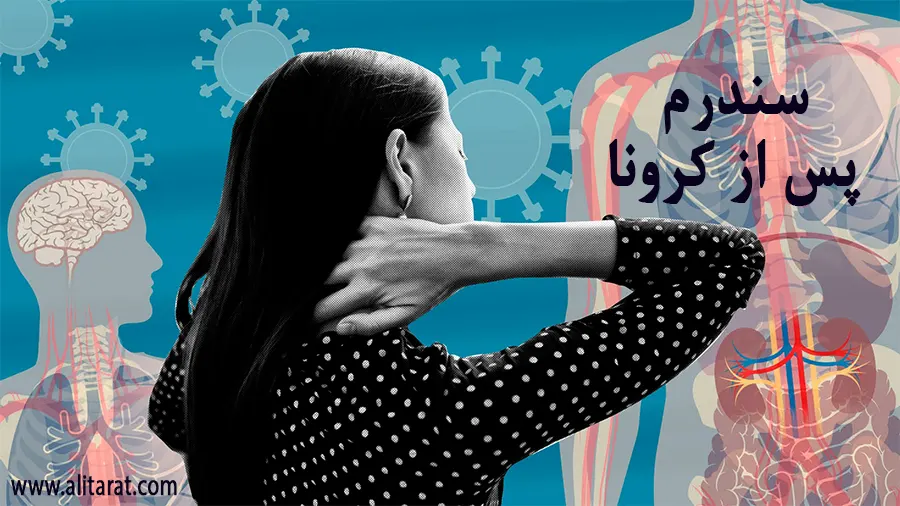 کووید طولانی