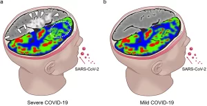 SARS-CoV-2 into the central nervous -long-term
