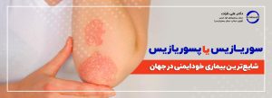سوریازیس، پسوریازیس یا صدفک پوستی شایع‌ترین بیماری خودایمنی در جهان است. مطب دکتر علی تارات