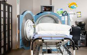 Hyperbaric Therapy for Skin Grafts and Flaps